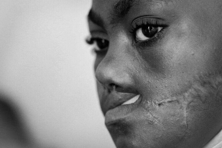 Secuelas de la violencia en Haití: heridas invisibles
