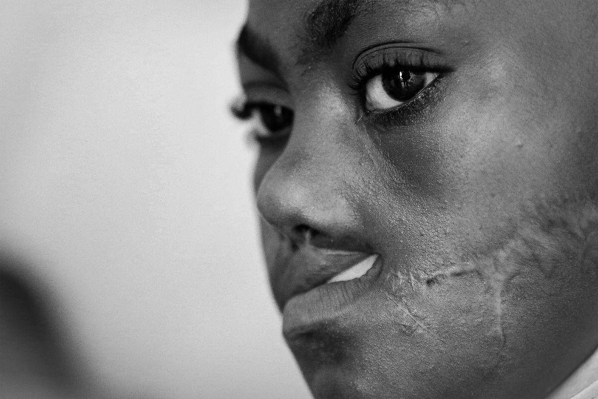 Secuelas de la violencia en Haití: heridas invisibles