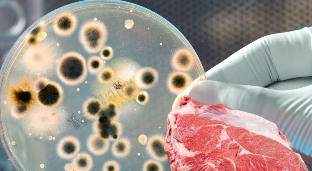 Ministerio de Salud aclara rumores sobre bacteria carnívora