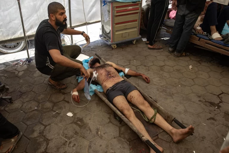 La Organización Mundial de la Salud dice que la guerra en Gaza ha causado 42.000 lesiones graves, incluidas 5.000 amputaciones