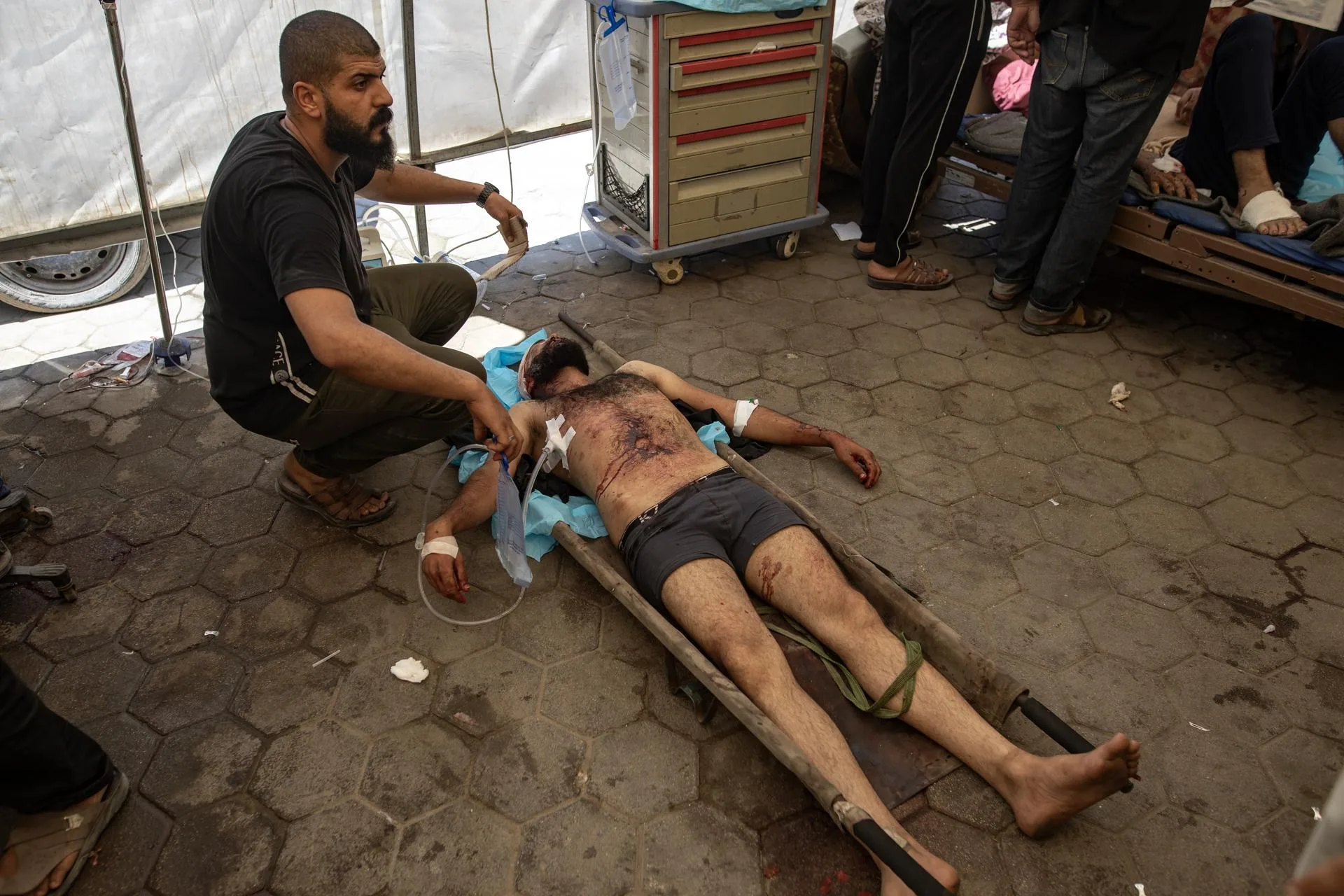 La Organización Mundial de la Salud dice que la guerra en Gaza ha causado 42.000 lesiones graves, incluidas 5.000 amputaciones