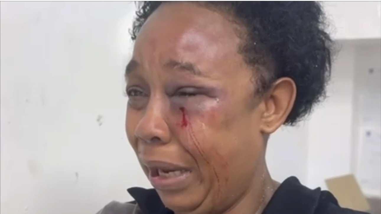 Hijo agrede “brutalmente” a su madre en SFM porque se negó a pagarle el doble de lo acordado por un trabajo de construcción