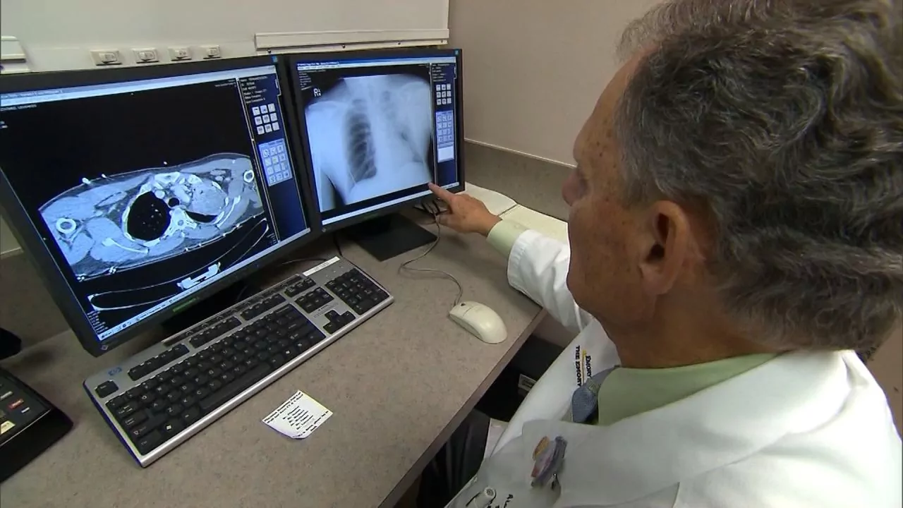 Por primera vez, la supervivencia al cáncer alcanza el 70 % en Estados Unidos